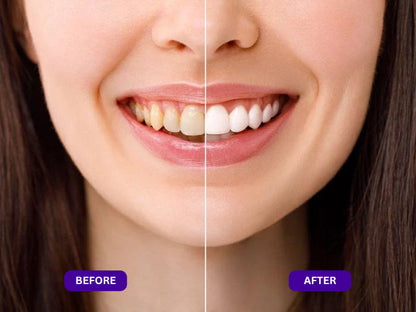 LOVILDS™ Purple Mouth Wash